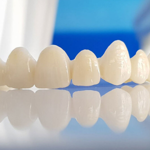 rang-su-tham-my-la-gi