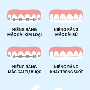 nieng-rang-tham-my-cac-phuong-phap-uu-nhuoc-diem-va-chi-phi
