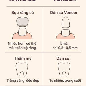 so-sanh-boc-su-va-dan-su-veneer