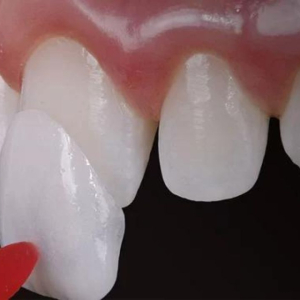 dan-su-la-gi-dan-su-khac-boc-su-nhu-the-nao