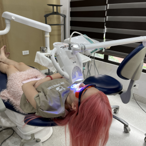 tay-trang-rang-nhung-dieu-can-luu-y