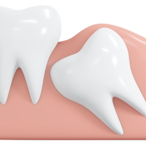 viem-loi-trum-rang-khon-nguyen-nhan-trieu-chung-va-cach-xu-ly