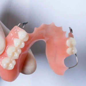 ham-giakhung-thao-lap-kim-loai-va-nhung-dieu-can-luu-y